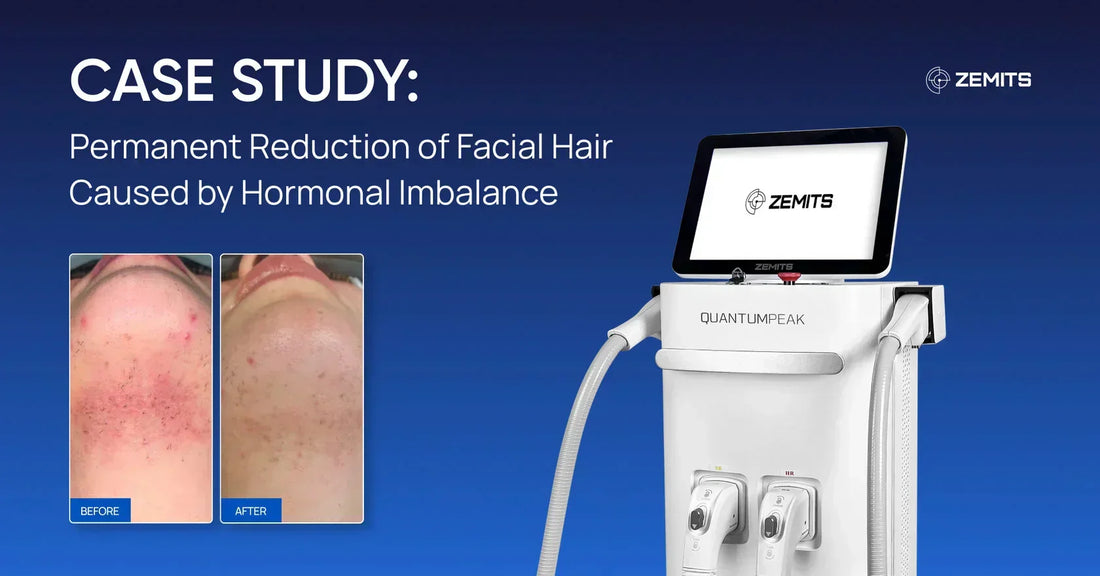 Case Study: Permanent Reduction of Facial Hair Caused by Hormonal Imbalance