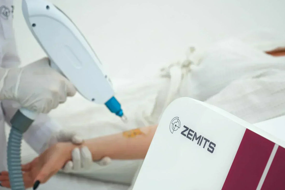 Expanding your business with the tattoo removal service: benefits, profit potential, treatment features