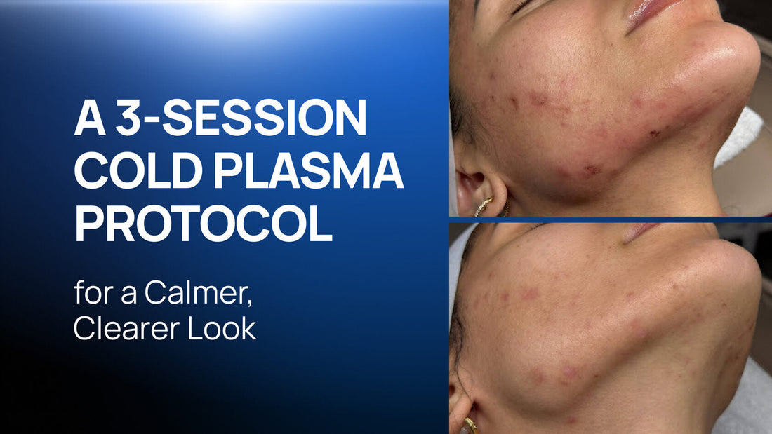How to Build a Cold Plasma Protocol for Breakout-Prone Skin: A Case Study After 3 Sessions