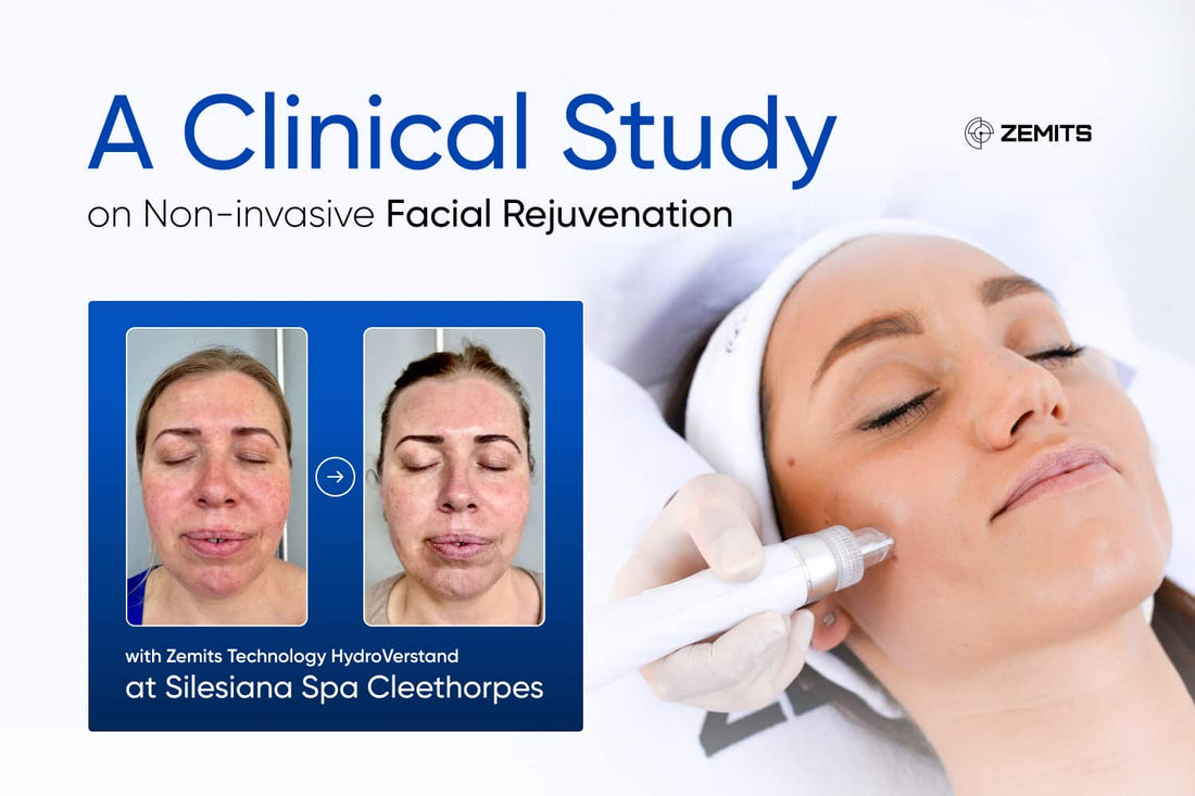 A Clinical Study on Non-invasive Facial Rejuvenation with Zemits Technology HydroVerstand at Silesiana Spa Cleethorpes