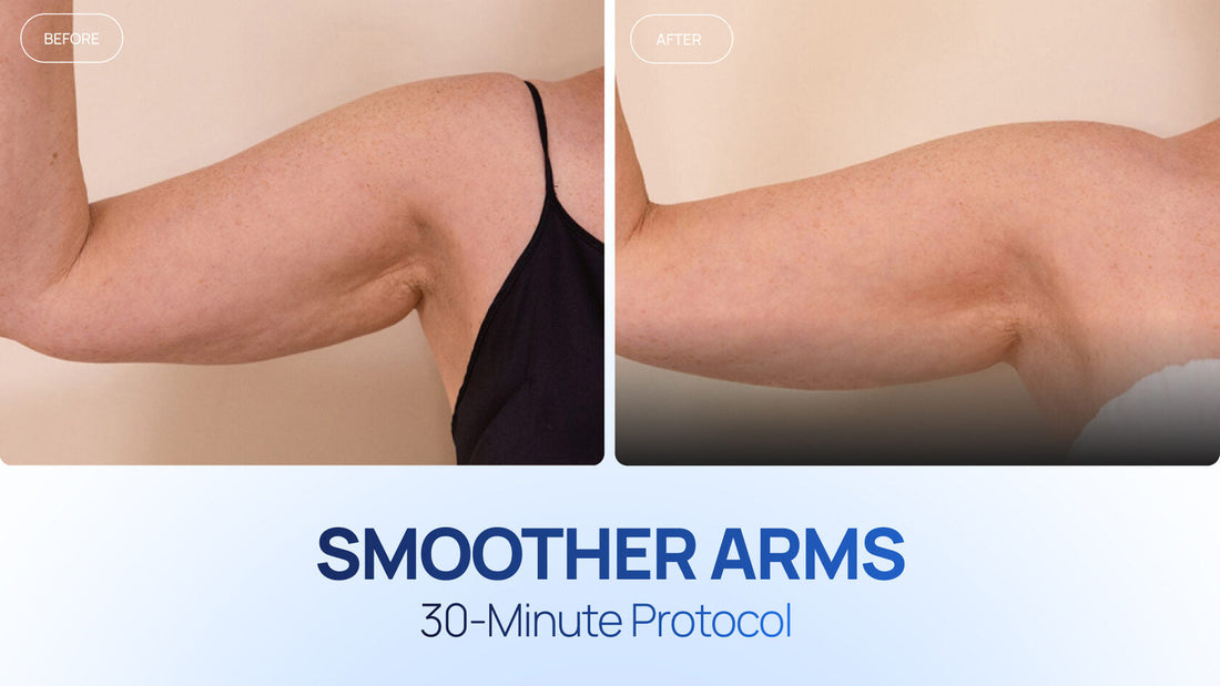 Cold Therapy for the Skin on the Arms: How One Session Supported a Firmer, Smoother Look