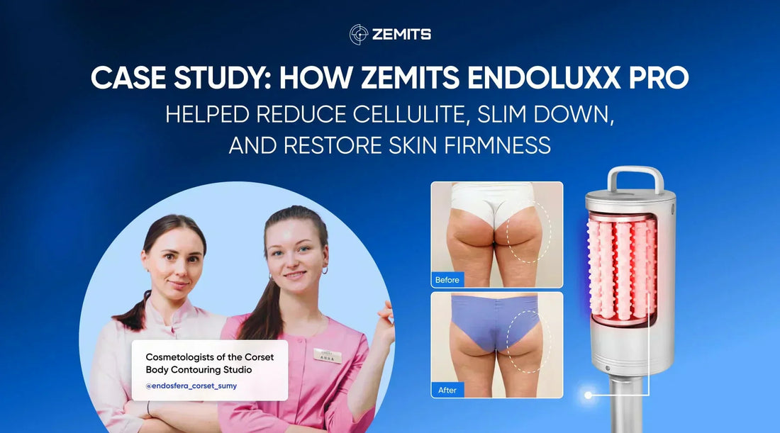 Case Study: How Zemits EndoLuxx Pro Helped Reduce Cellulite, Slim Down, and Restore Skin Firmness