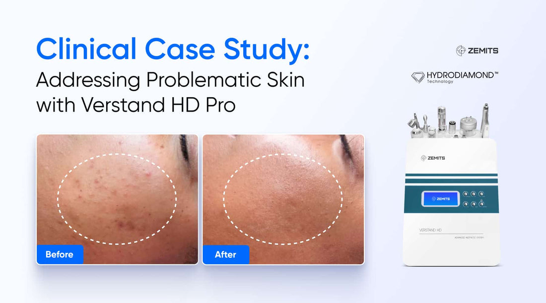 Clinical Case Study: Addressing Problematic Skin with Verstand HD Pro