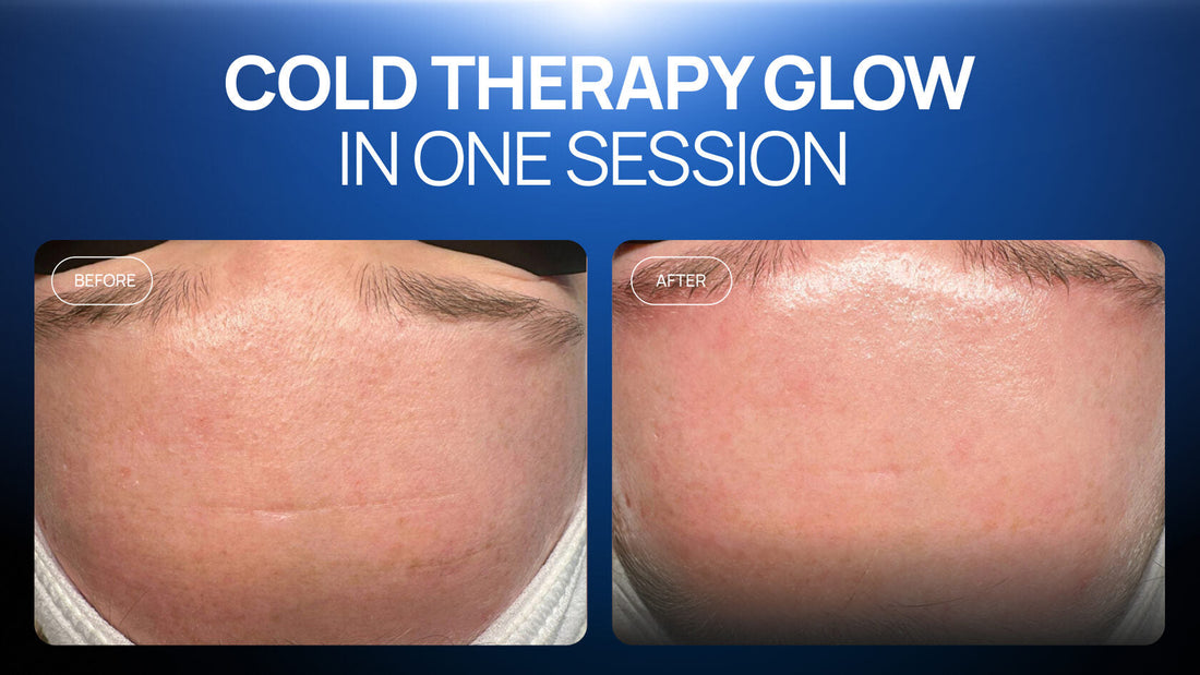 How to Refresh Dull Skin and Soften the Look of Forehead Lines in One Session