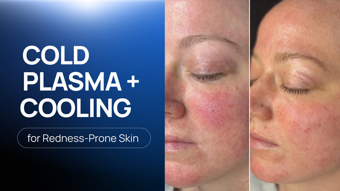 How a Multi-Step Cold Plasma and Cold Therapy Protocol Calmed the Look of Redness in 3 Sessions
