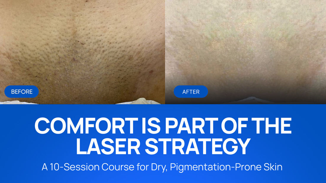 A Comfortable Laser Hair Removal Course for Dry, Pigmentation-Prone Skin: 10 Sessions for Fitzpatrick Skin Type III