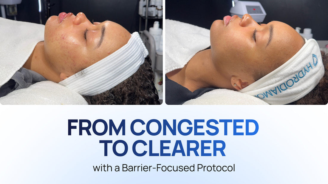 How to Build a Barrier-Focused Protocol for Combination, Acne-Prone Skin