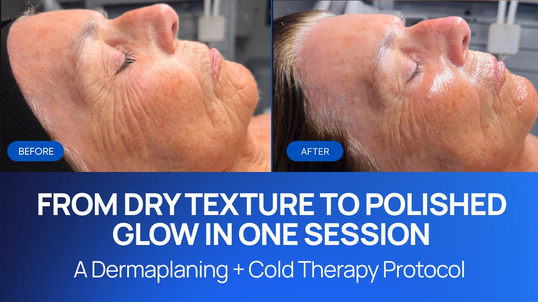 Dermaplaning + Cold Therapy for Dehydrated Skin with Fine Lines