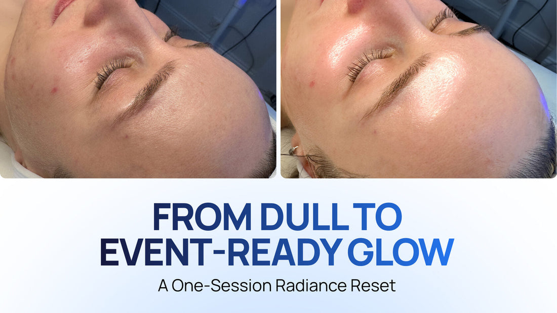 Pre-Event Glow: How a HydroDiamond Facial Refreshed Dull-Looking Skin in One Session
