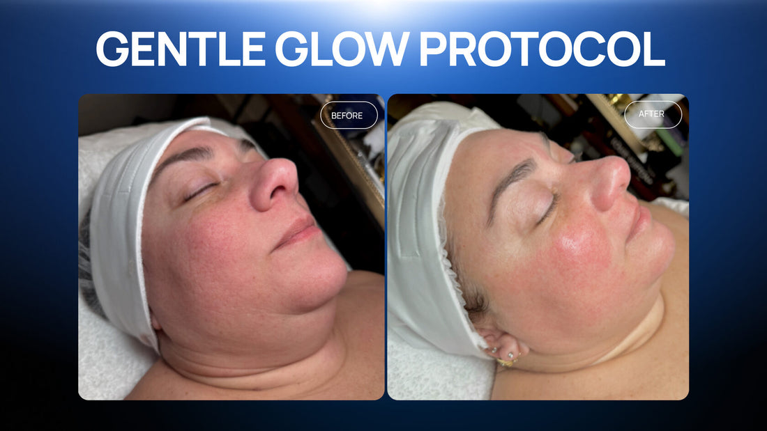 A Gentle Glow Protocol for Sensitive, Redness-Prone Skin — in One Session