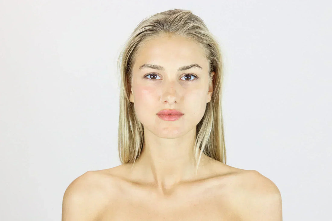 Leave It Behind: How to Get Rid Of Acne Once And For All