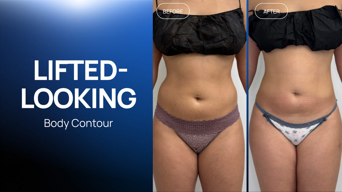 A Layered Body-Contouring Protocol: Zemits Qumotion and Zemits Bionexis Lite Pro