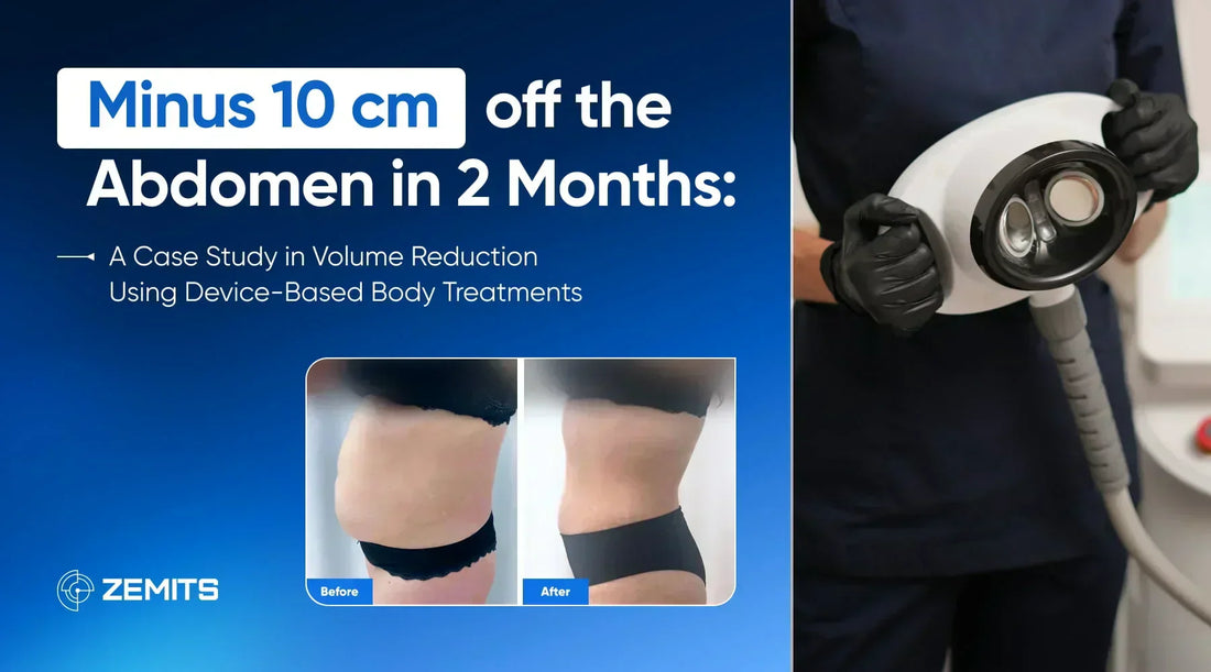 Minus 10 cm off the Abdomen in 2 Months: A Case Study in Volume Reduction Using Device-Based Body Treatments