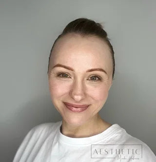 Case study: Aesthetic practitioner Monika Hofmann combines Microneedling RF with Exosomes for Hyperpigmentation and Acne Scarring Treatment
