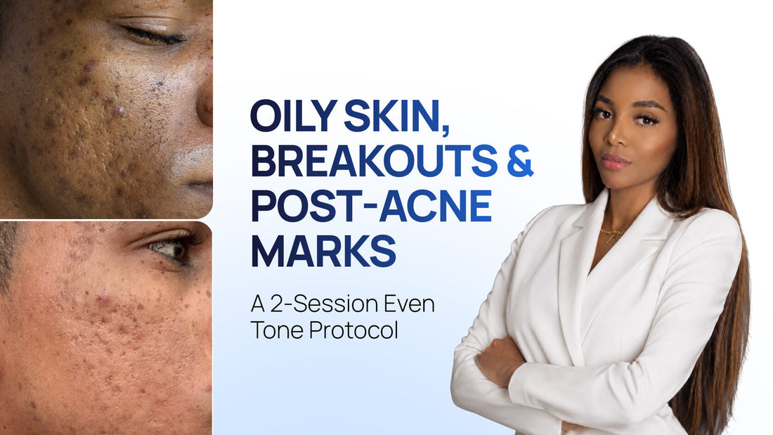 HydroDiamond + Cold Plasma: A Protocol for Oily Skin with Post-Inflammatory Hyperpigmentation