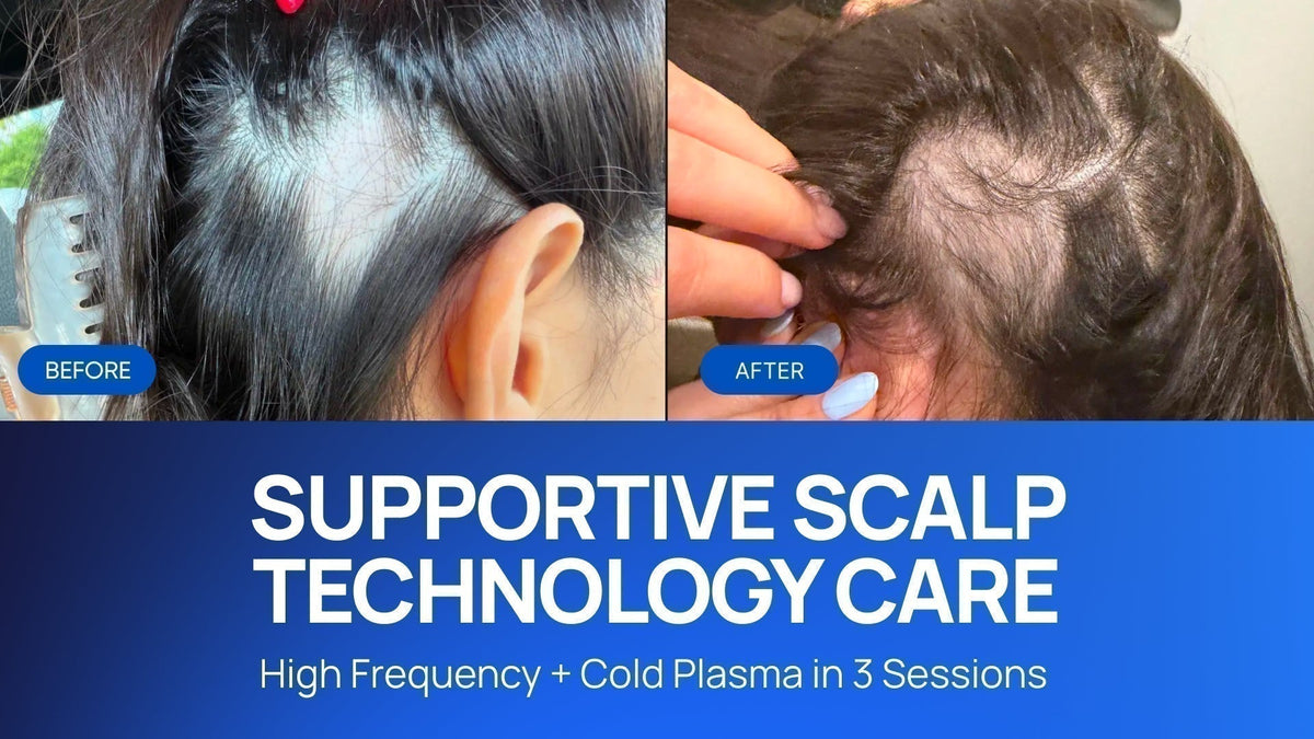 Three supportive scalp sessions. A cleaner-looking scalp and visible progress in focal areas. Explore how High Frequency and Cold Plasma fit into this device-based scalp care protocol 