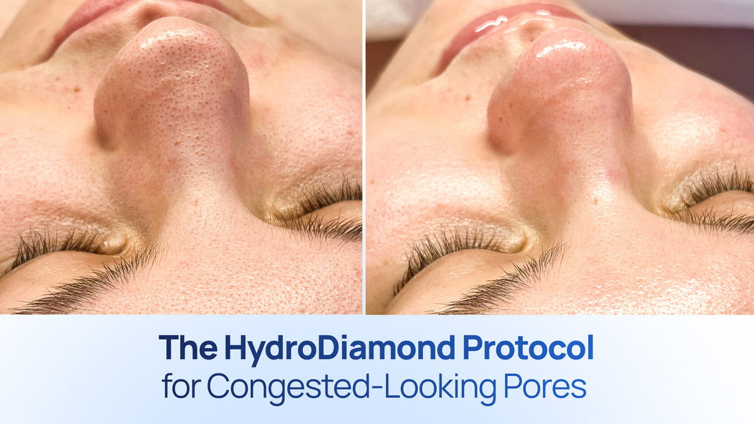 How to Build a HydroDiamond Protocol for Congested Pores