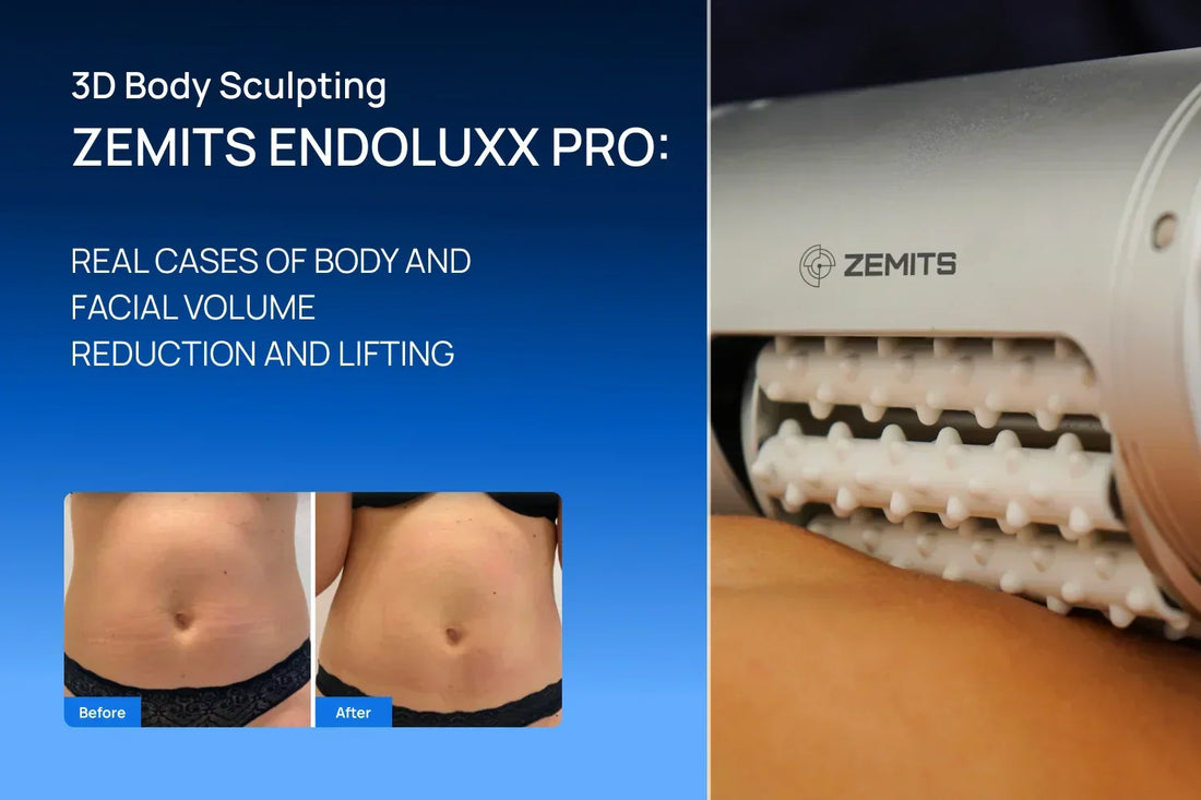 How to Effectively Reduce Cellulite with EndoLuxx Pro and 3D Body Sculpting