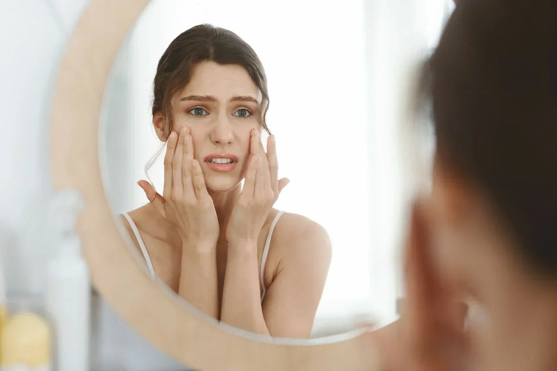 Are you stressed out? Your skin can show it