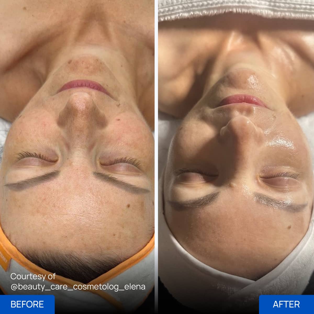 Before After Slide 1