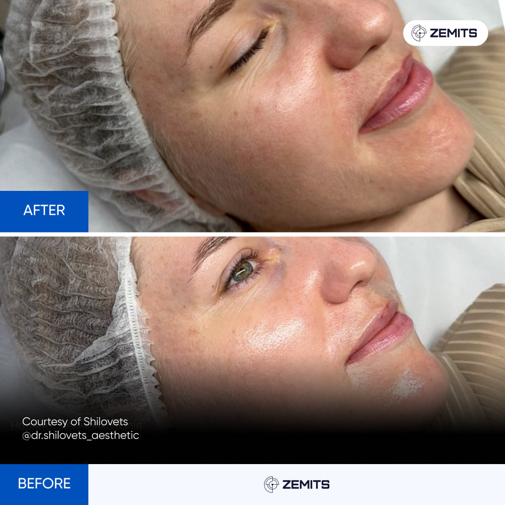 Before After Slide 3