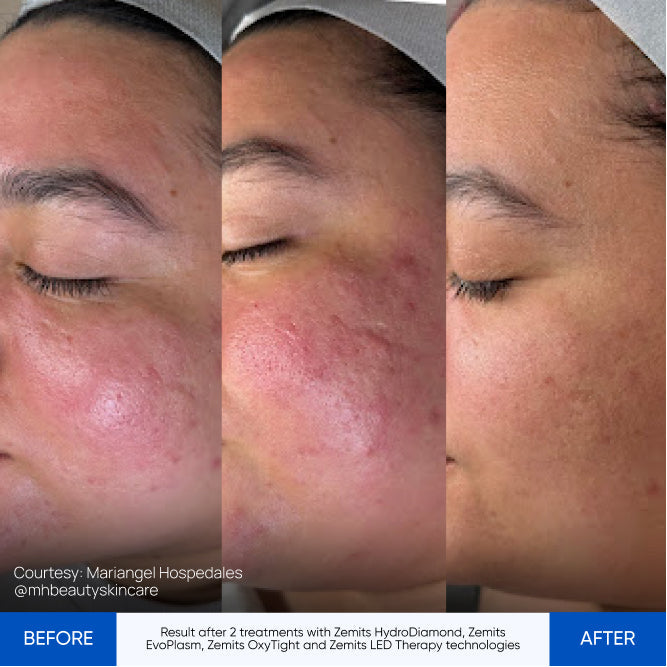 Before After Slide 1