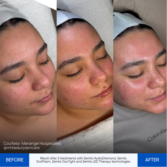 Before After Slide 2