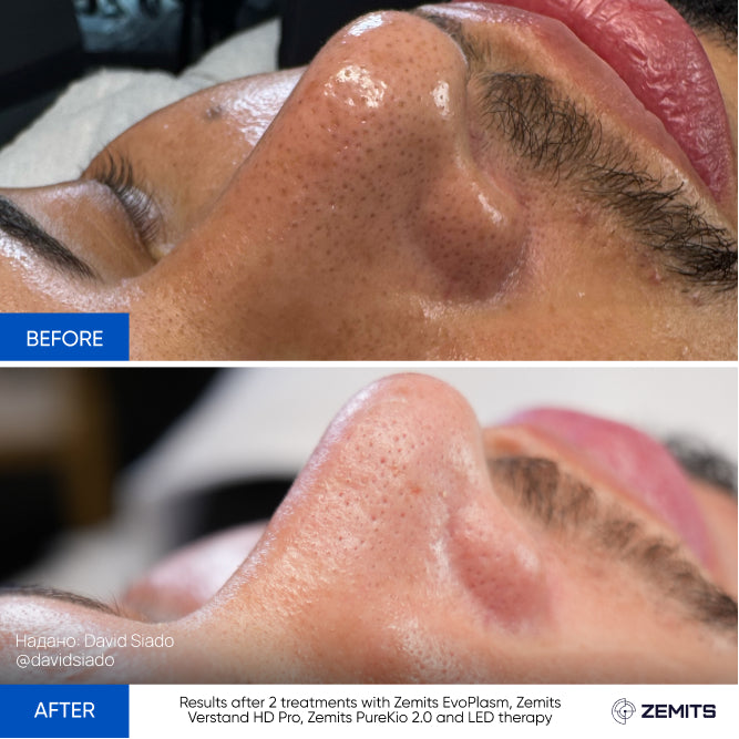 Before After Slide 2