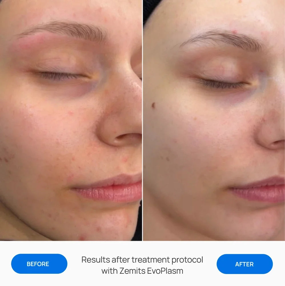 Before After Slide 1