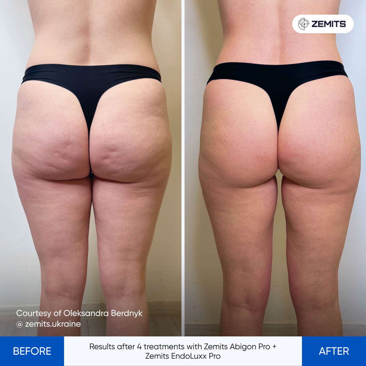 Before After Slide 6
