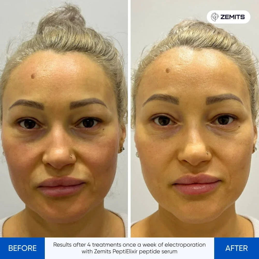 Before After Slide 2