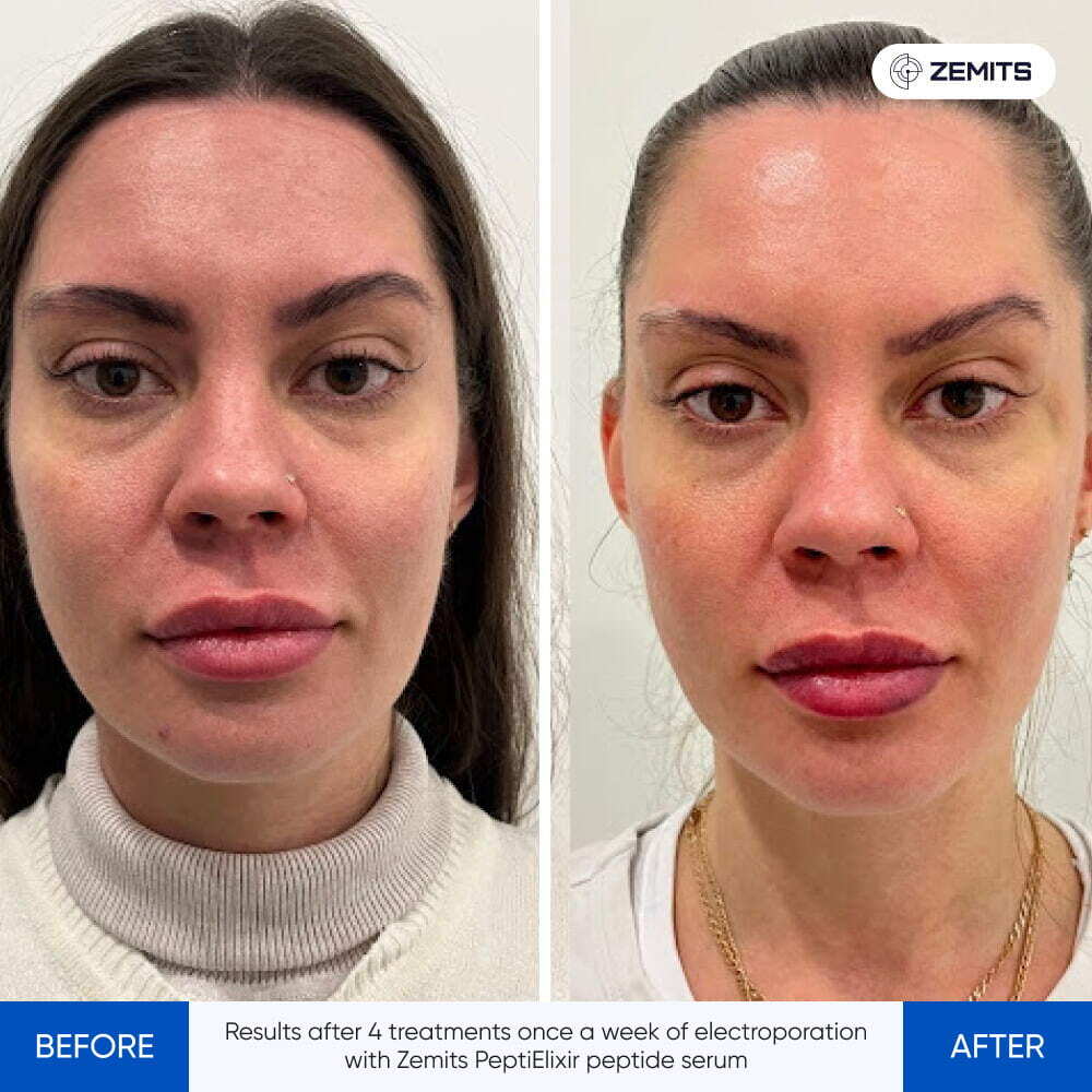 Before After Slide 4