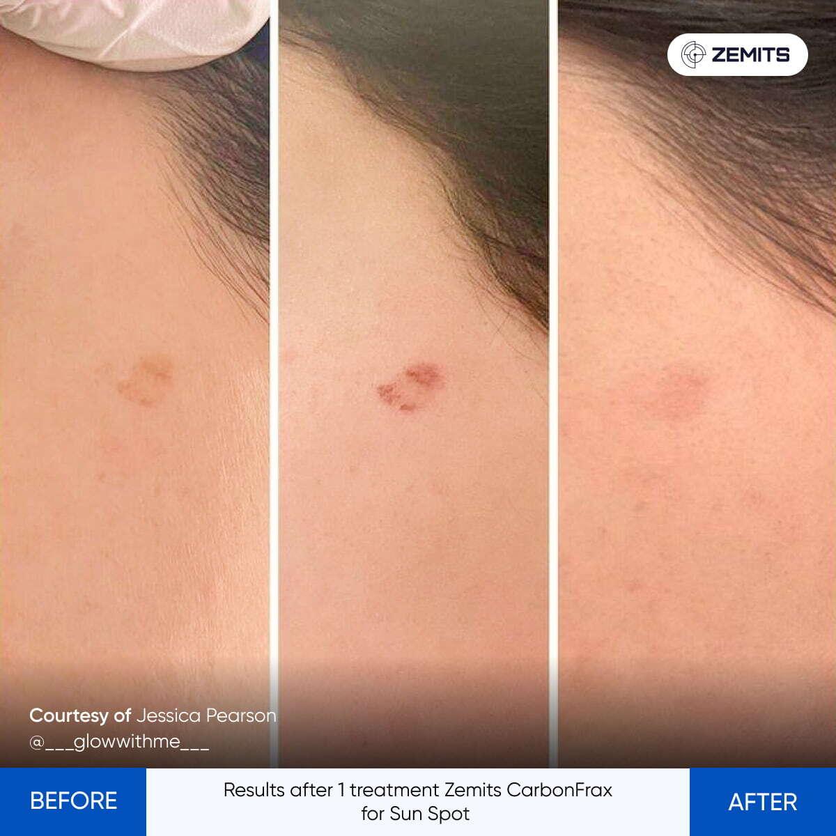 Before After Slide 1