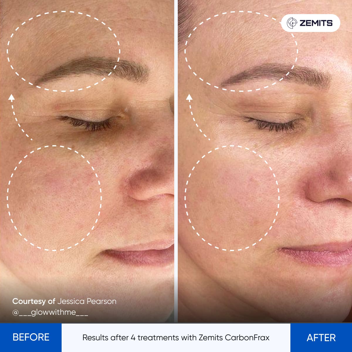 Before After Slide 6