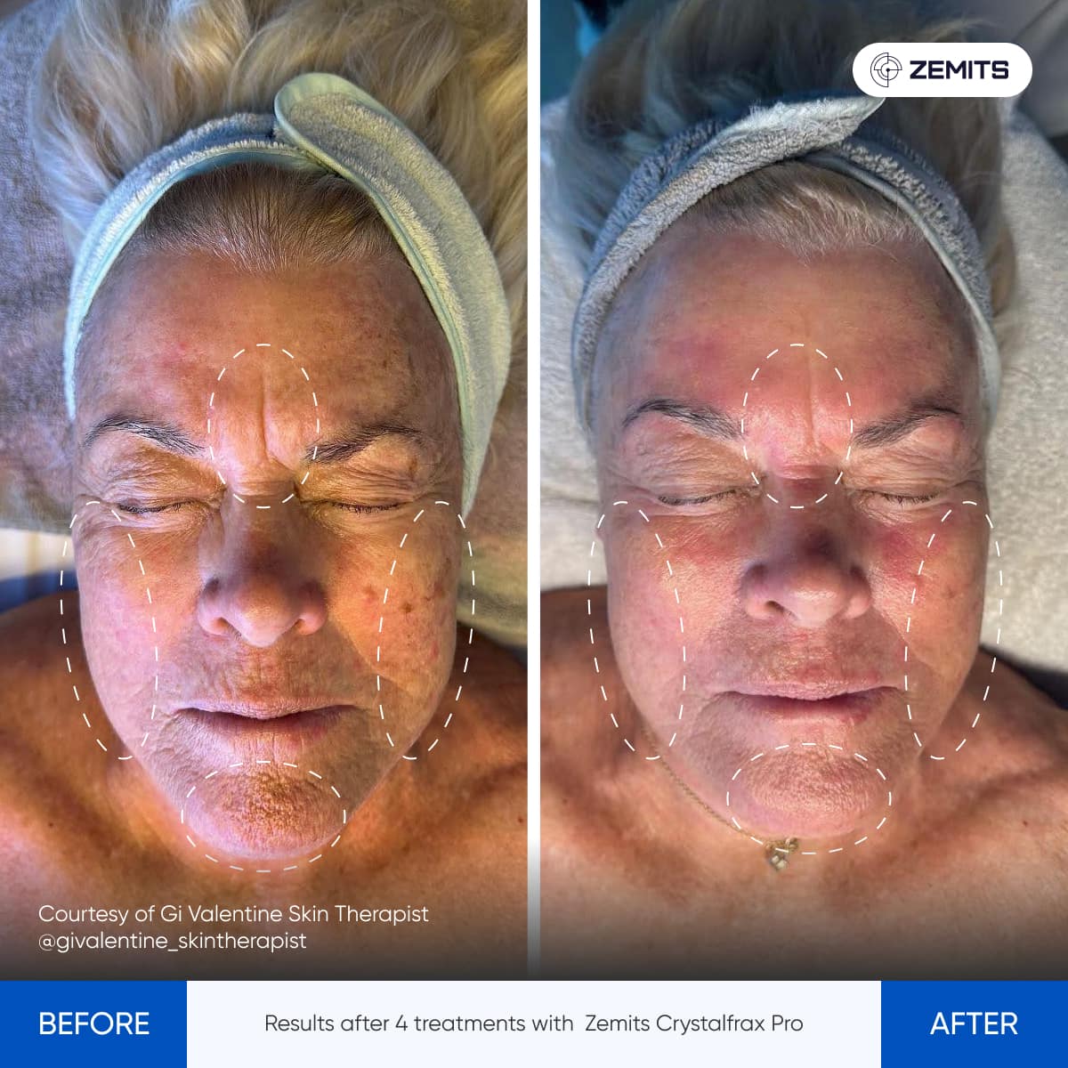 Before After Slide 9