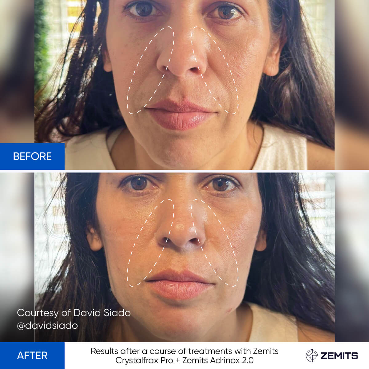 Before After Slide 18