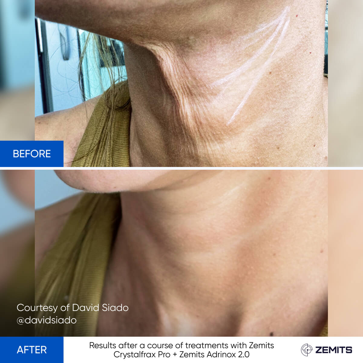 Before After Slide 19