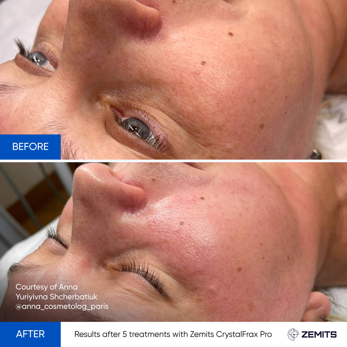 Before After Slide 22