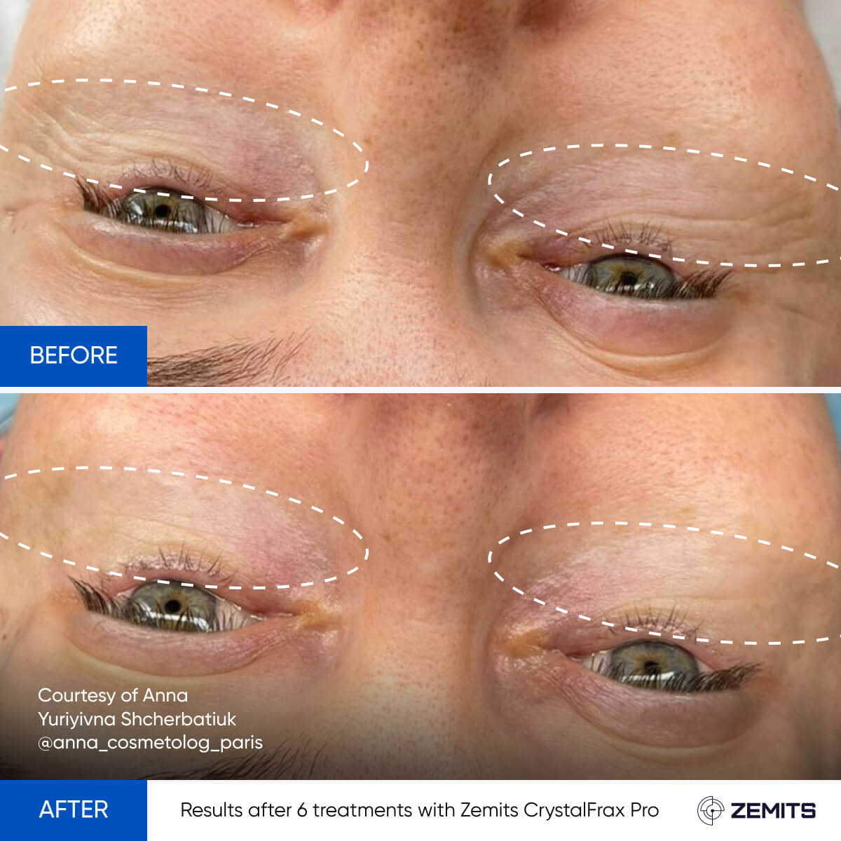 Before After Slide 23