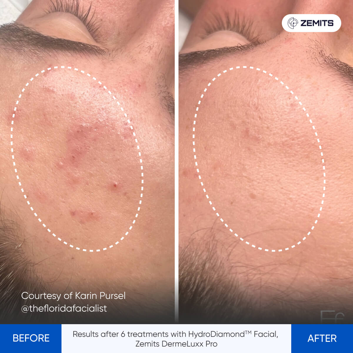 Before After Slide 1