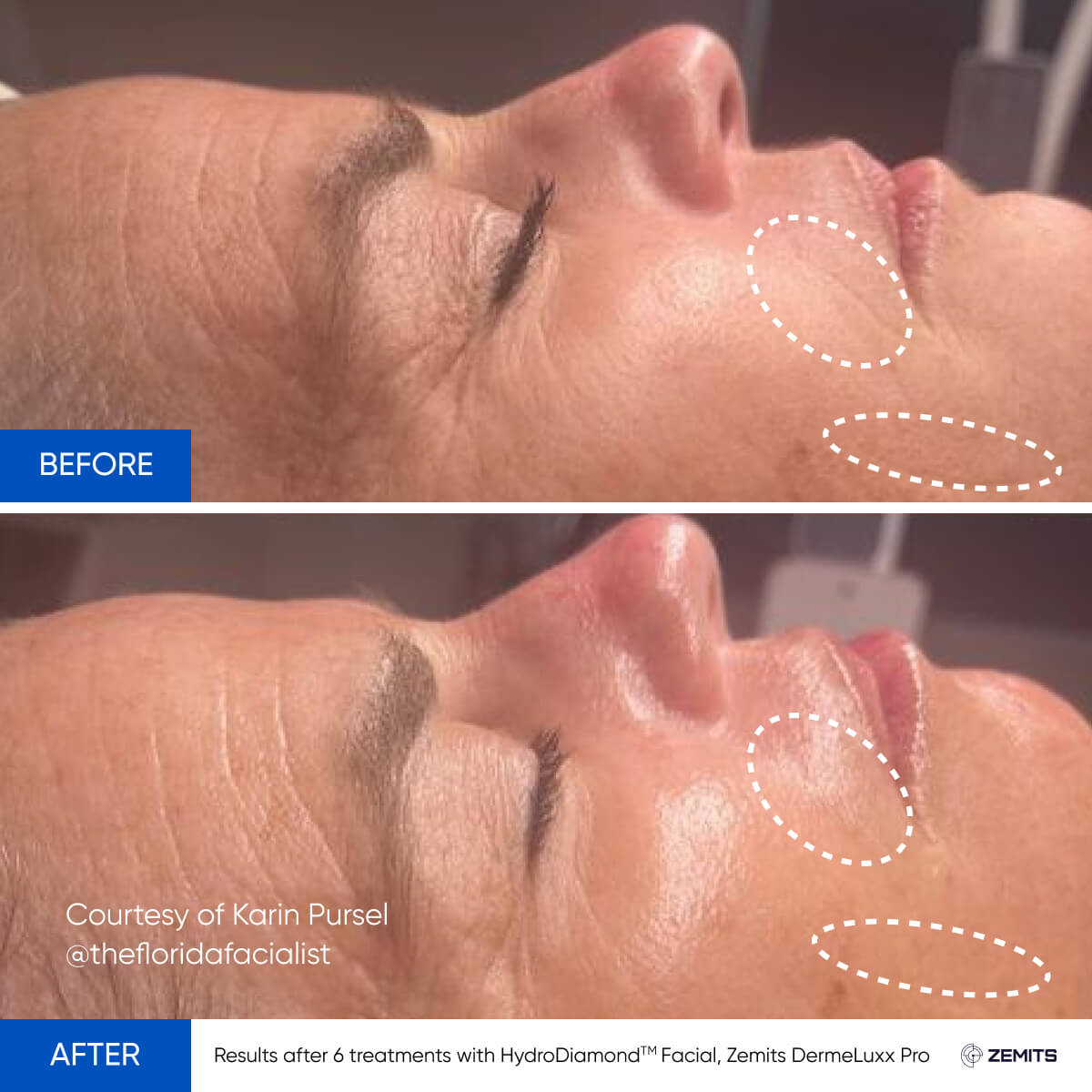Before After Slide 2