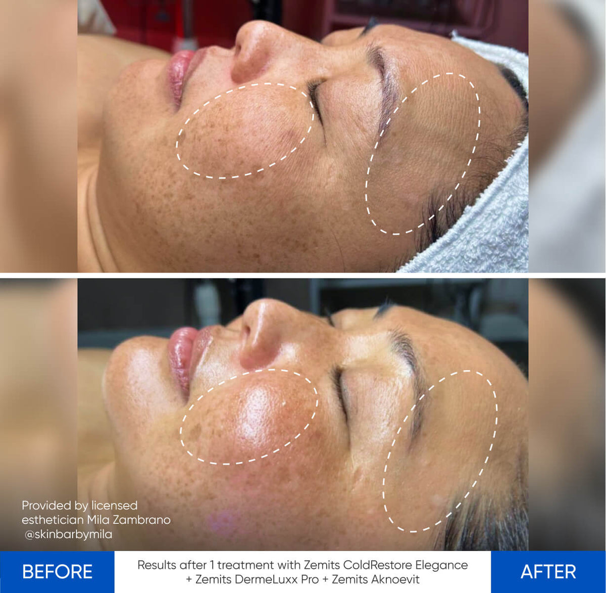 Before After Slide 19