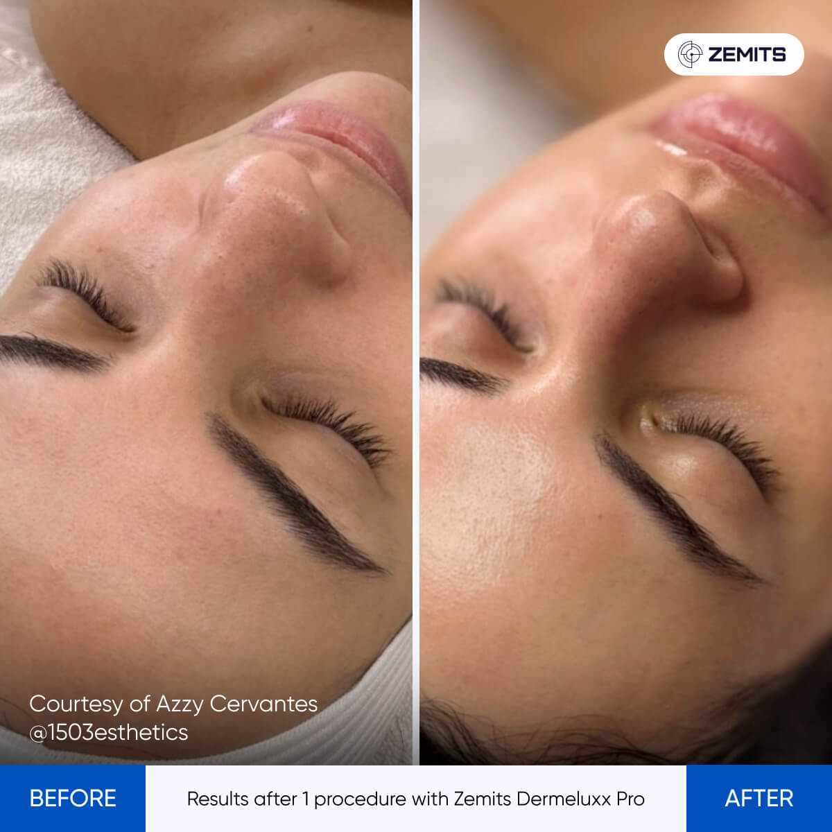 Before After Slide 4