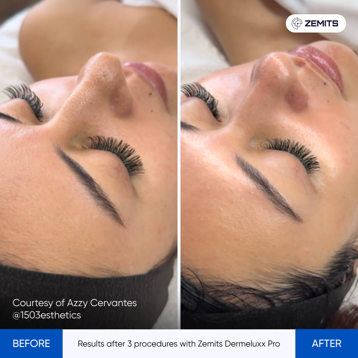 Before After Slide 5