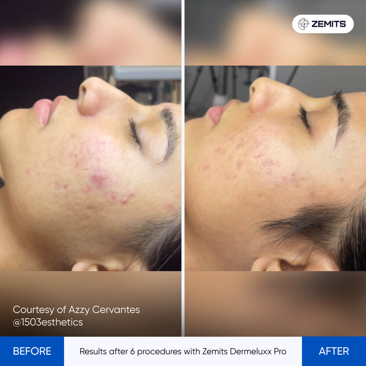 Before After Slide 6