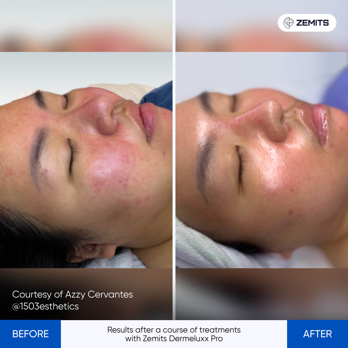 Before After Slide 7
