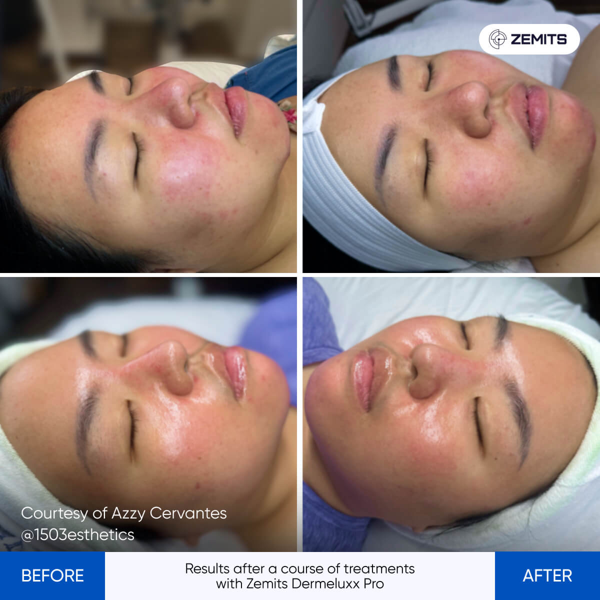 Before After Slide 8