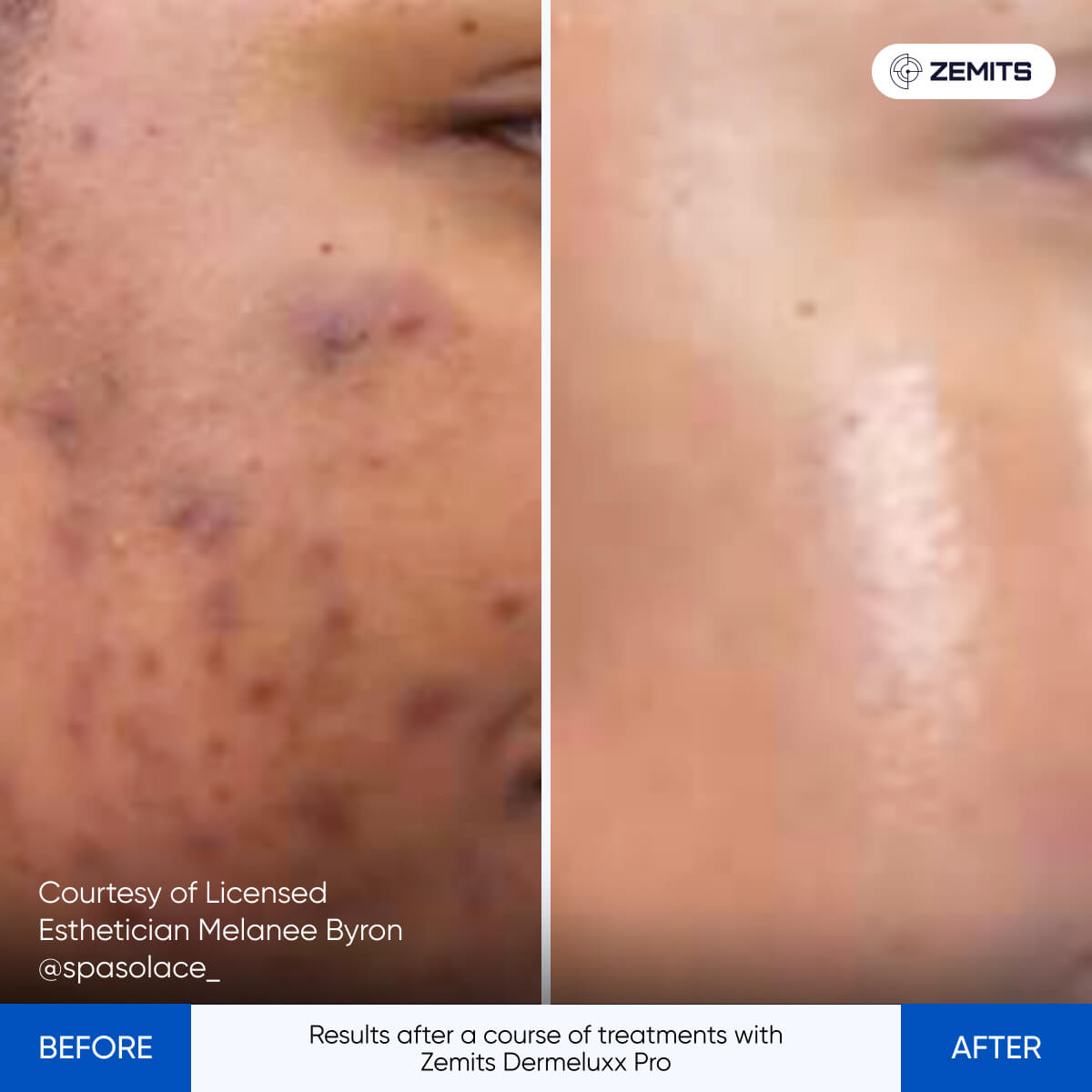 Before After Slide 9