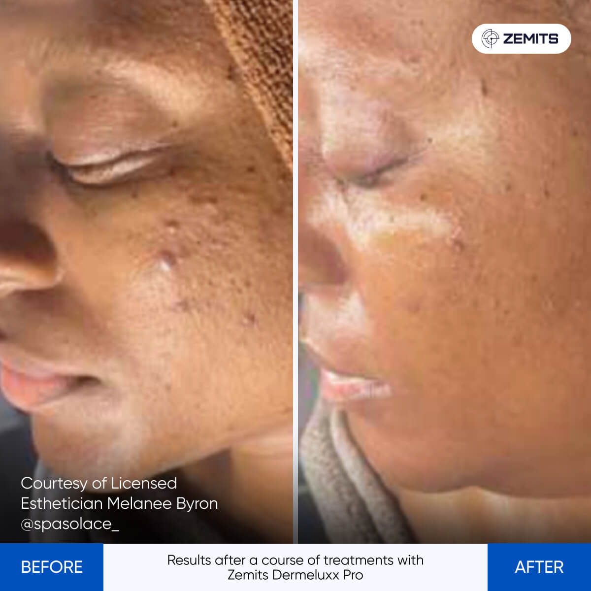 Before After Slide 10