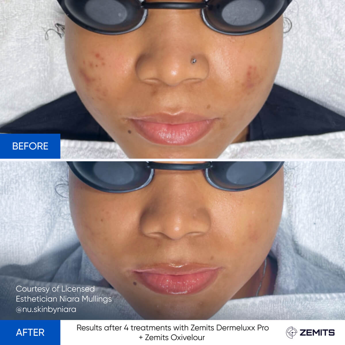 Before After Slide 11